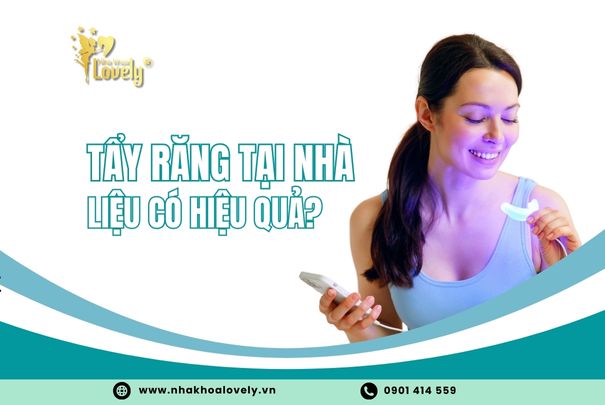 tẩy trắng răng tại nhà liệu có hiệu quả