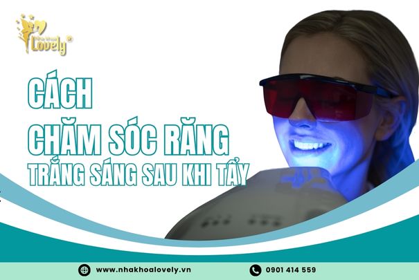 cách chăm sóc răng trắng sáng sau khi tẩy
