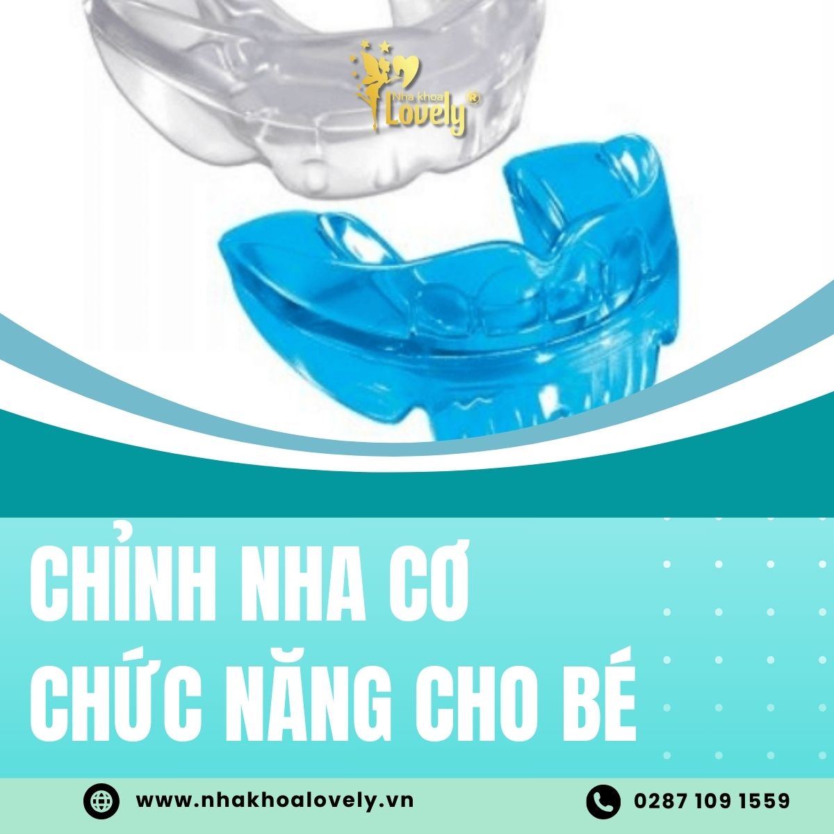Chỉnh nha cơ chức năng cho bé