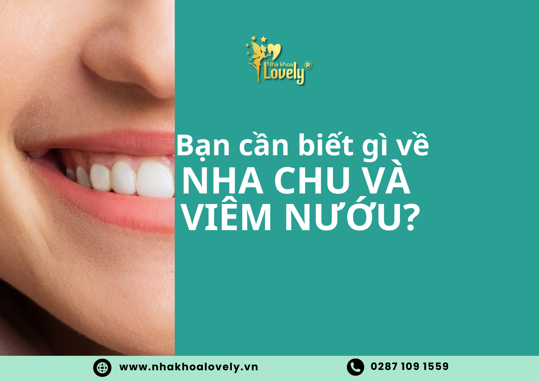 Bạn cần biết gì về nha chu và Viêm Nướu