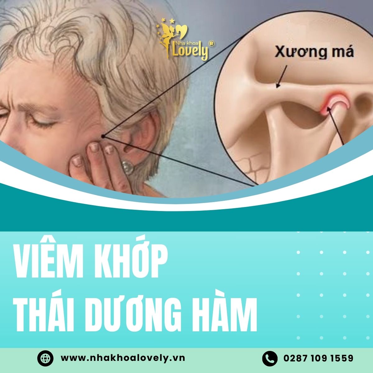 Viêm khớp thái dương hàm